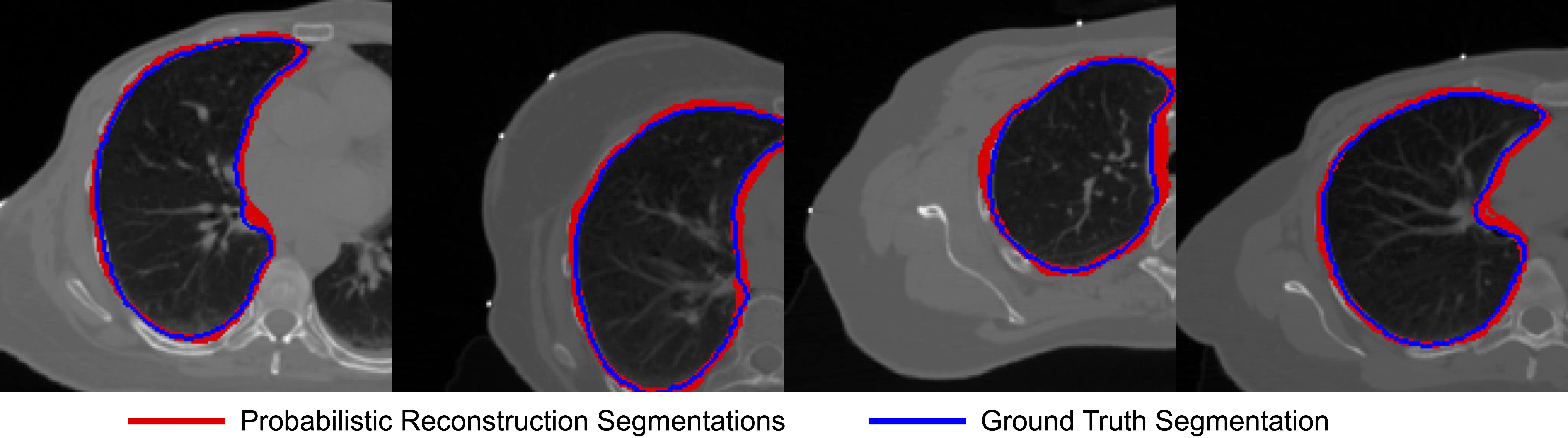 Bias-Aware Conformal Prediction for Metric-Based Imaging Pipelines