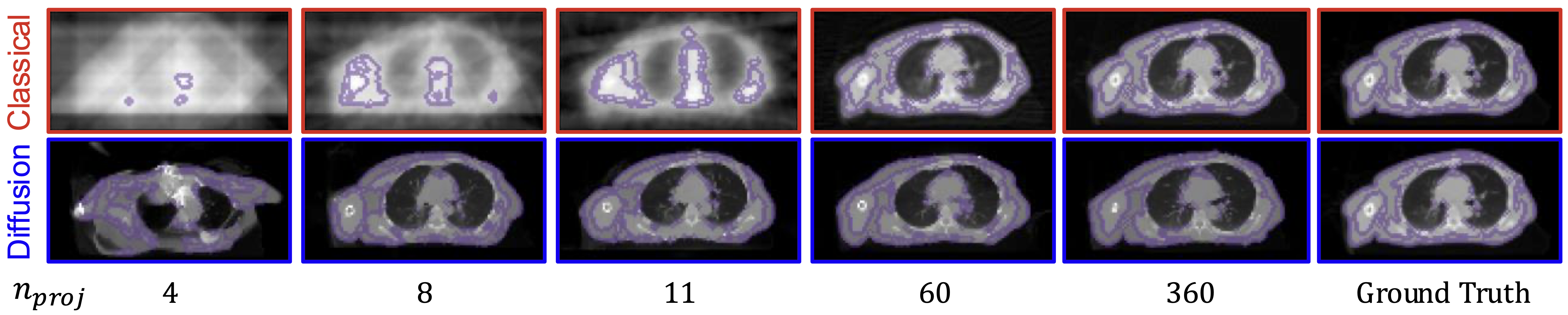 Diffusion priors in sparse-view CT